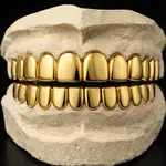 Gold Grillz