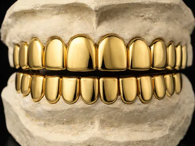 Gold Teeth Nation